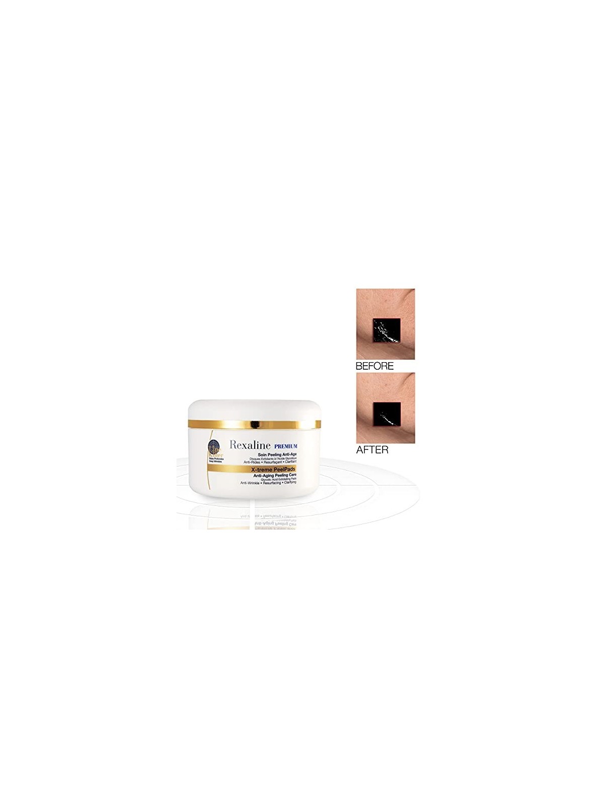 Peeling anti-etï¿½ï¿½ Rexaline Premium Line Killer X-treme