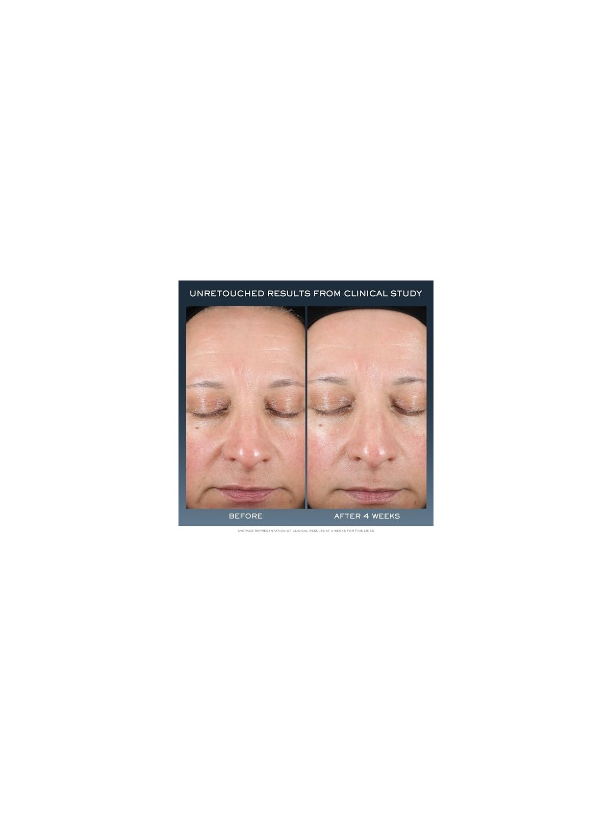 Lancome Advanced Genifique Night Repairing Cream 50ml Suitable For All Skin Types, Even Sensitive Lancome www.essenzetotalstyle.