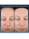 Lancome Advanced Genifique Night Repairing Cream 50ml Suitable For All Skin Types, Even Sensitive Lancome www.essenzetotalstyle.