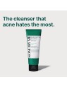 Schiuma antiacne Some By Mi AHA-BHA-PHA 30 giorni 100 ml