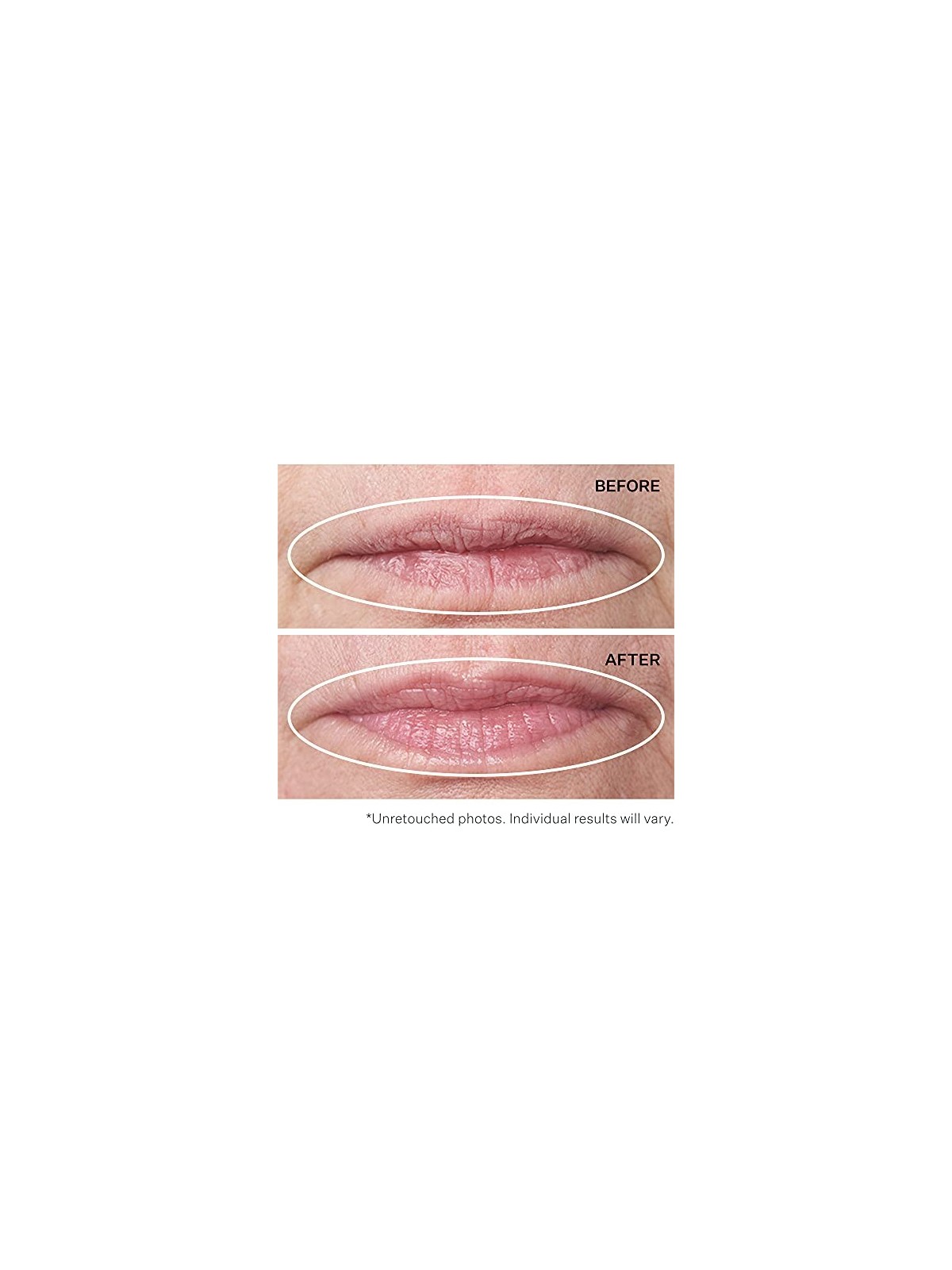 Strivectin Double Fixï¿½ï¿½ï¿½ per Labbra 10ml