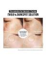 Suntique I M 88 Dark Spot Solution 30ml