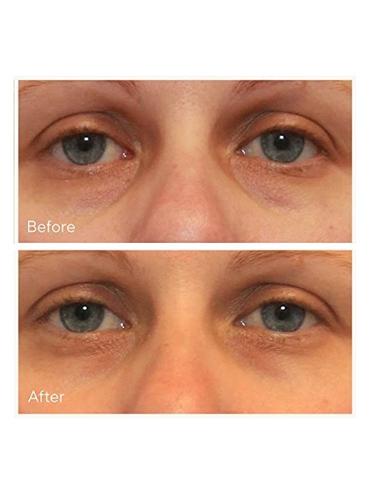 Murad Vita-C Rapid Dark Circle Corrector 15ml Murad www.essenzetotalstyle.com 