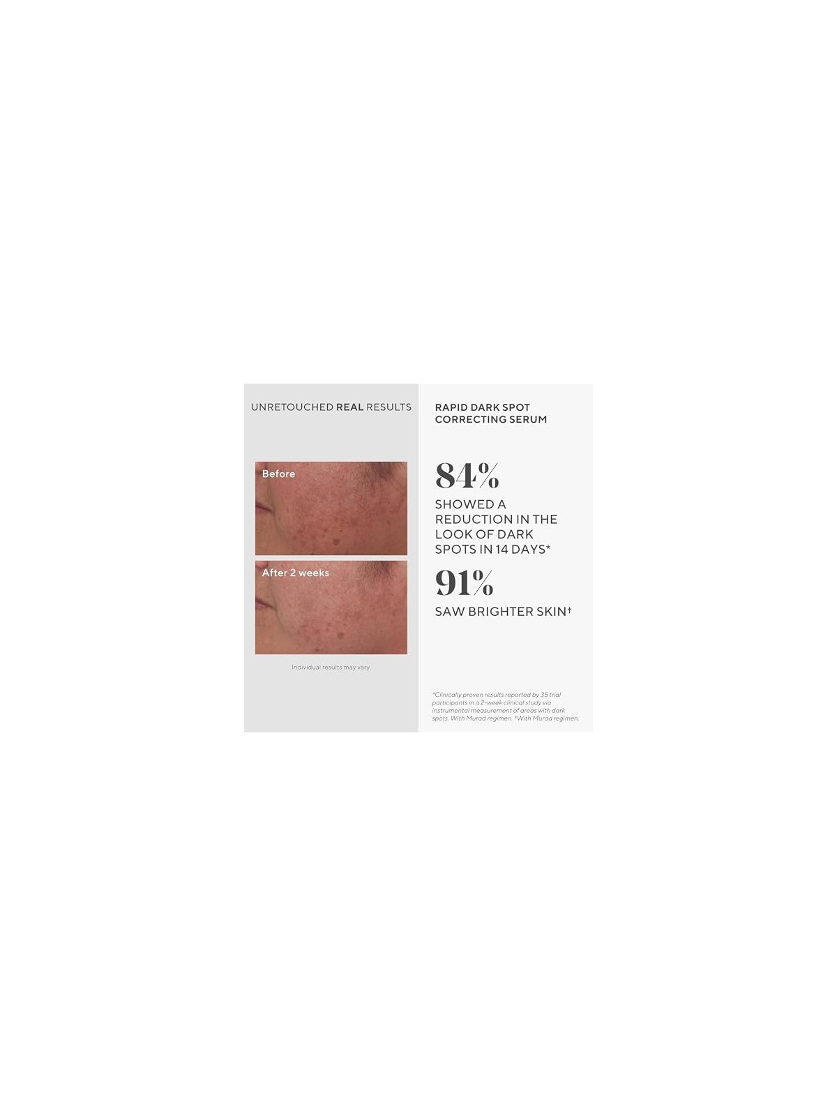 Murad Environmental Shield Rapid Dark Spot Correcting Serum 30ml