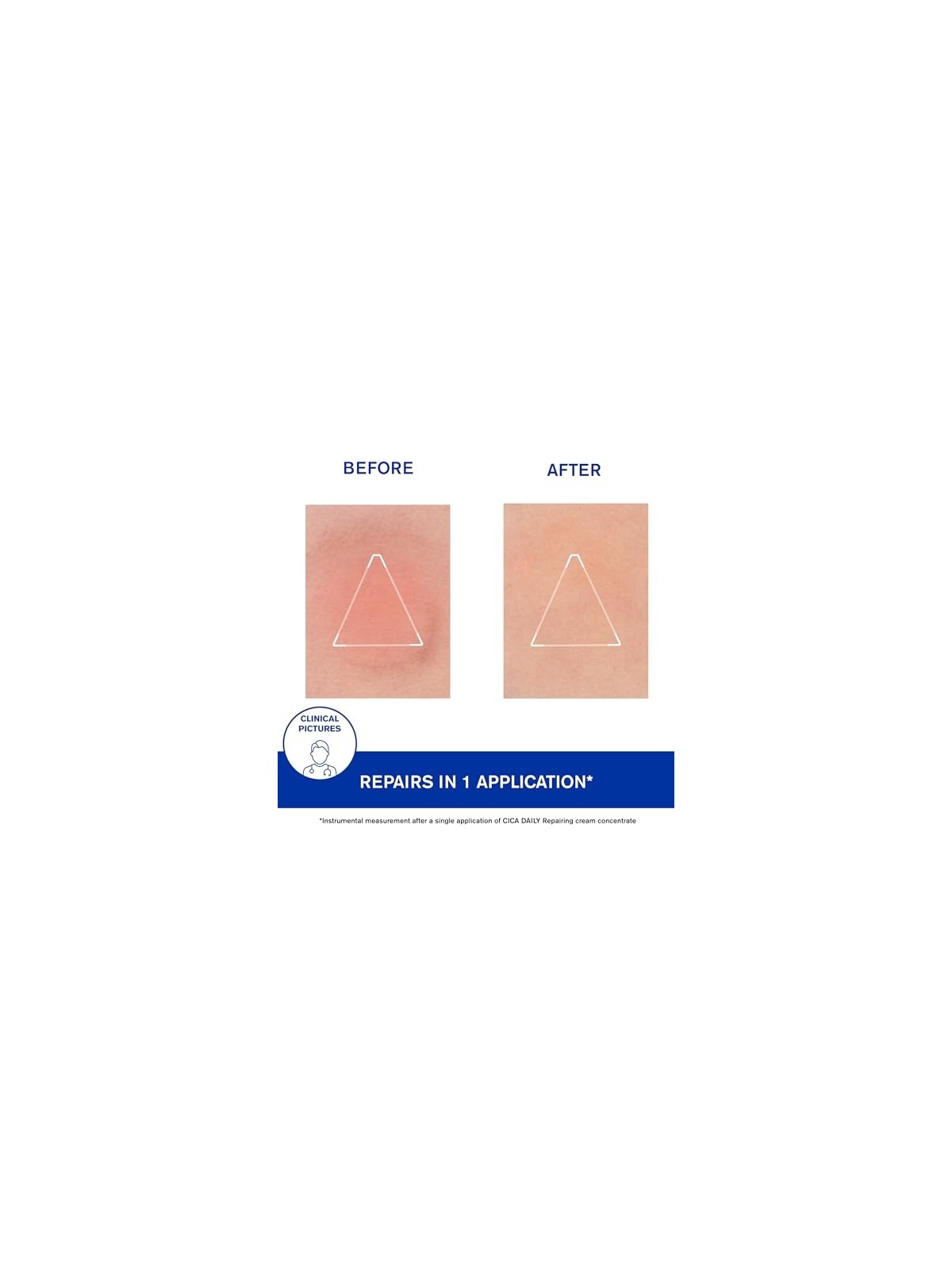 Siero quotidiano Uriage BARIï¿½ï¿½DERM cica-daily 30ml