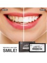 VitalCare White Pearl White Teeth sbiancamento dei denti donna