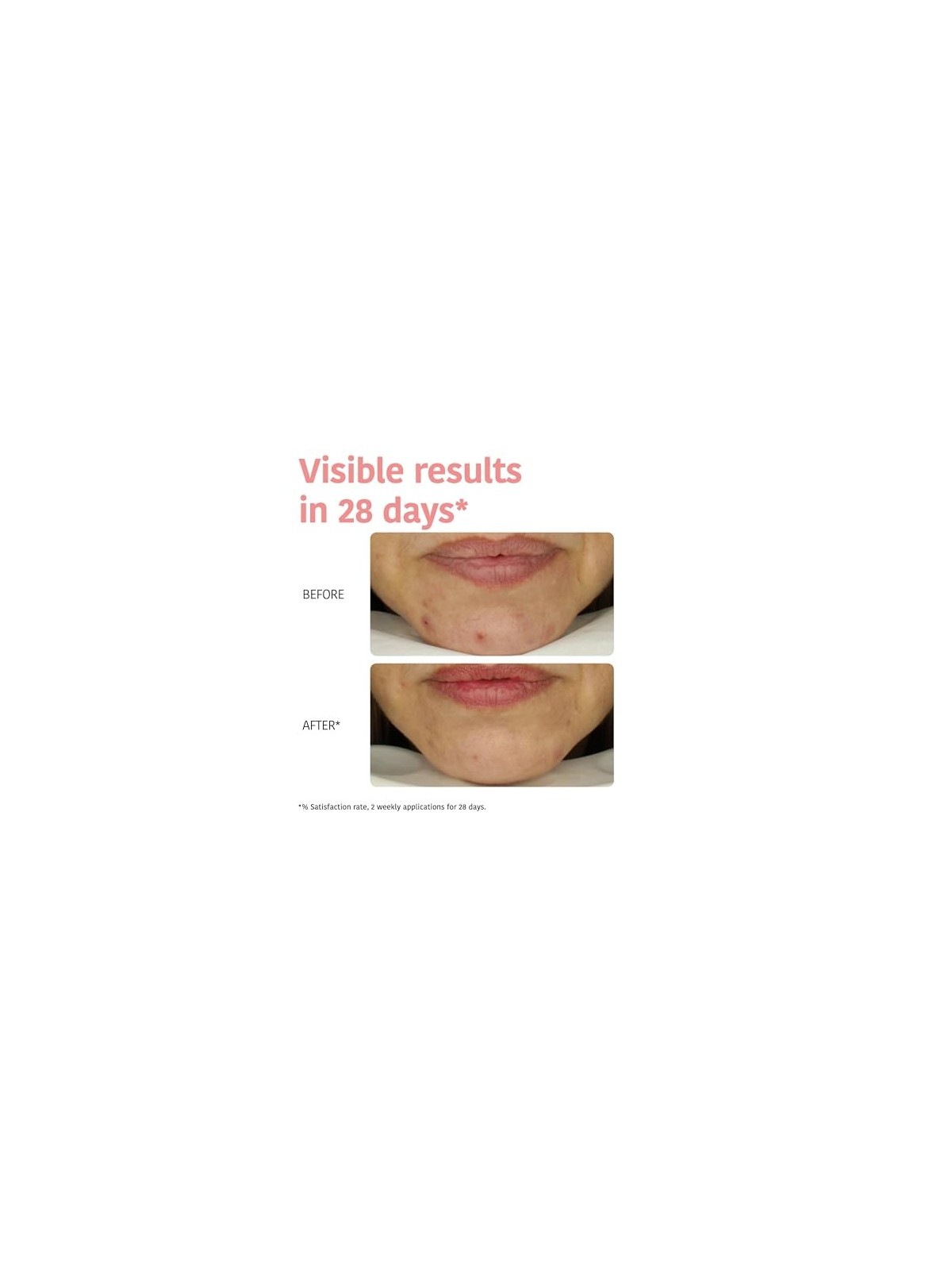 Iroha PERFECT SKIN PEELING acido glicolico e centella asiatica