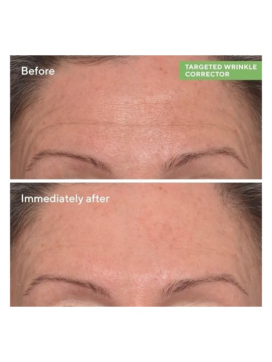 Murad Resurgence Targeted Wrinkle Corrector 15ml