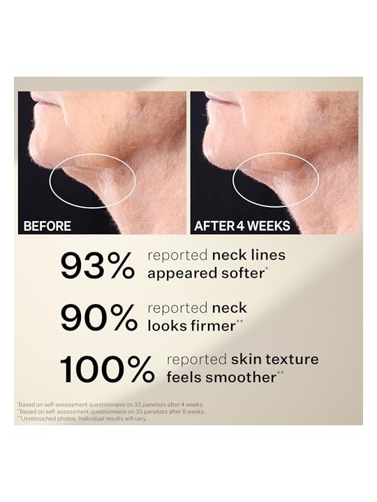 Strivectin Peptight Tightening Neck Serum Roller 50ml