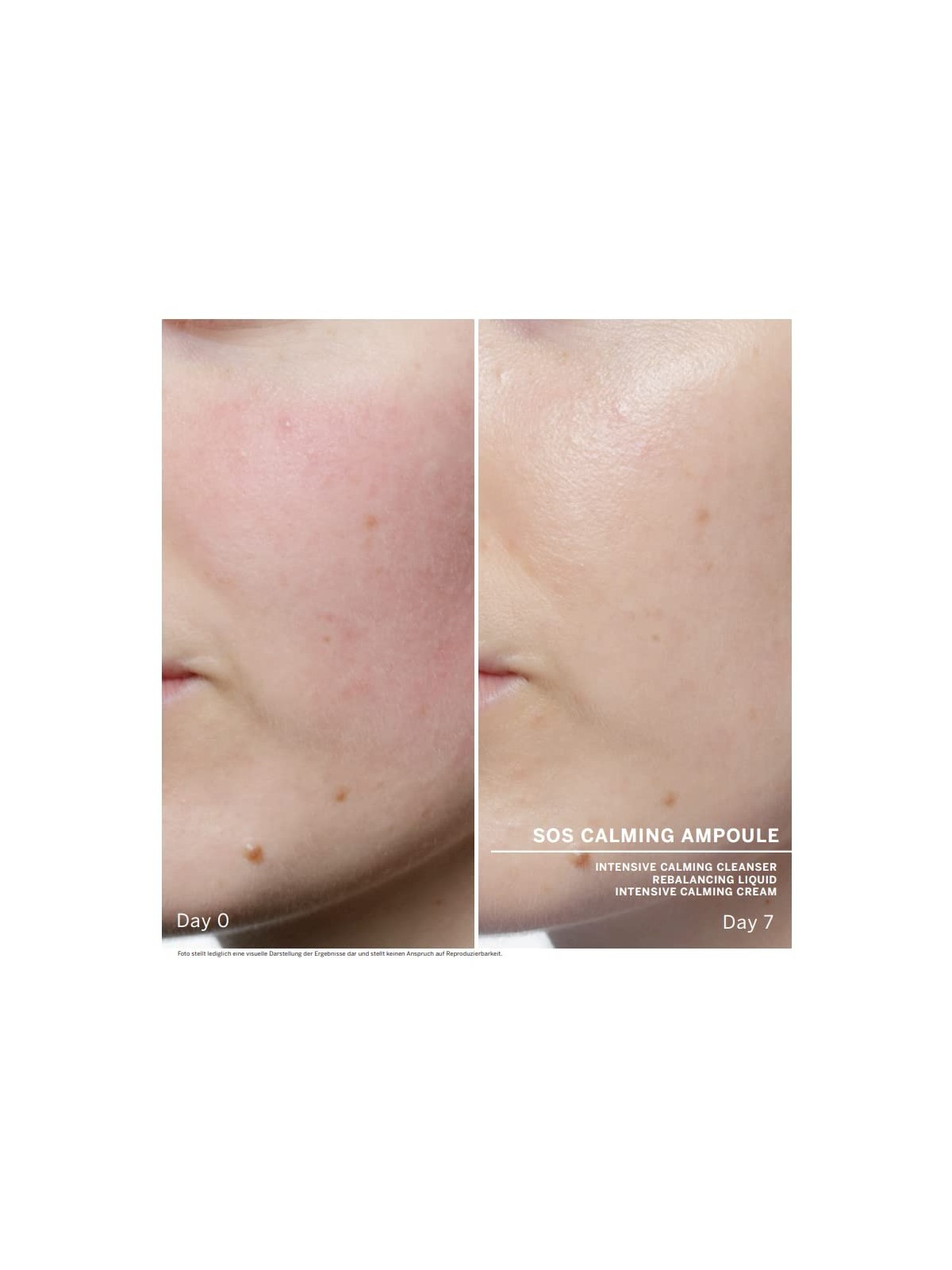 Fiale viso Babor SOS Calming Ampoule Concentrates donna 14ml 7x2ml-Sensitive & Irritated Skin