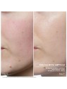 Fiale viso Babor SOS Calming Ampoule Concentrates donna 14ml 7x2ml-Sensitive & Irritated Skin