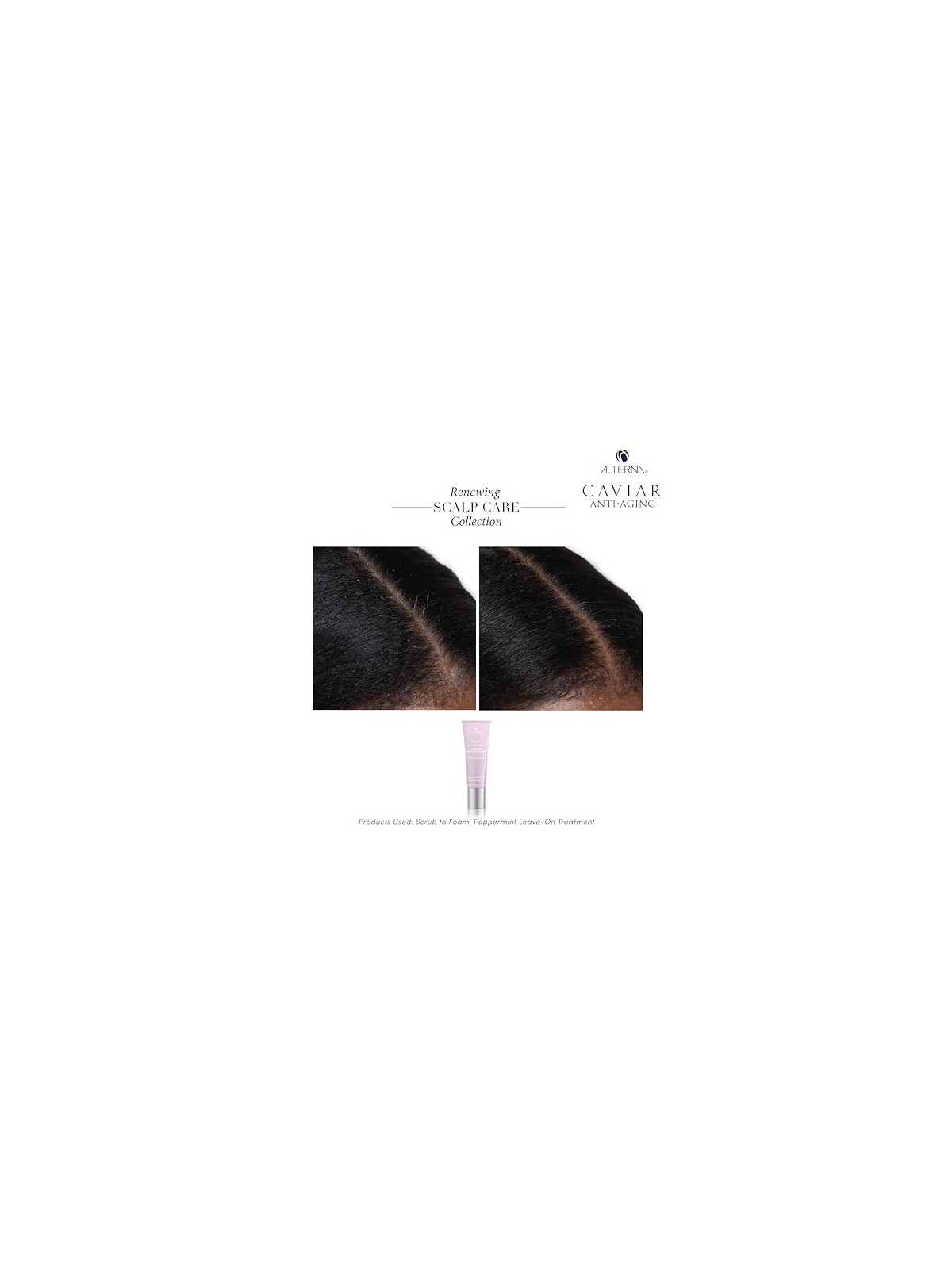 Alterna Scalp Renewal with Peppermint Serum Moisture Balancing 74ml