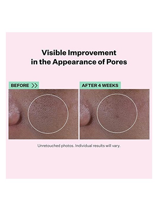 Super Shrink Pore Minimizing Serum 30ml