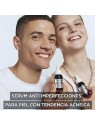 GARNIER PURE ACTIVE AHA BHA CARBONE siero antiimperfezioni 30ml donna