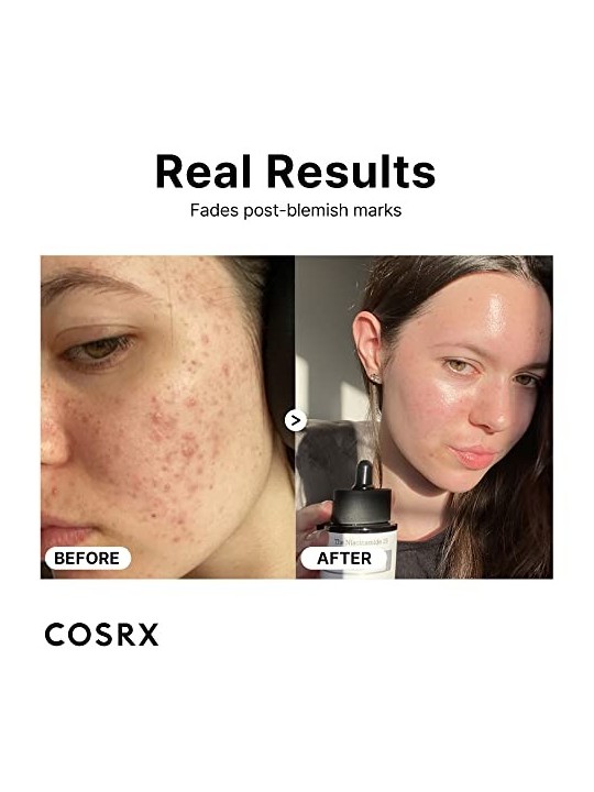 Cosrx The Niacinamide 15 Serum 20ml acquista 