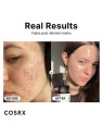 Cosrx The Niacinamide 15 Serum 20ml acquista 