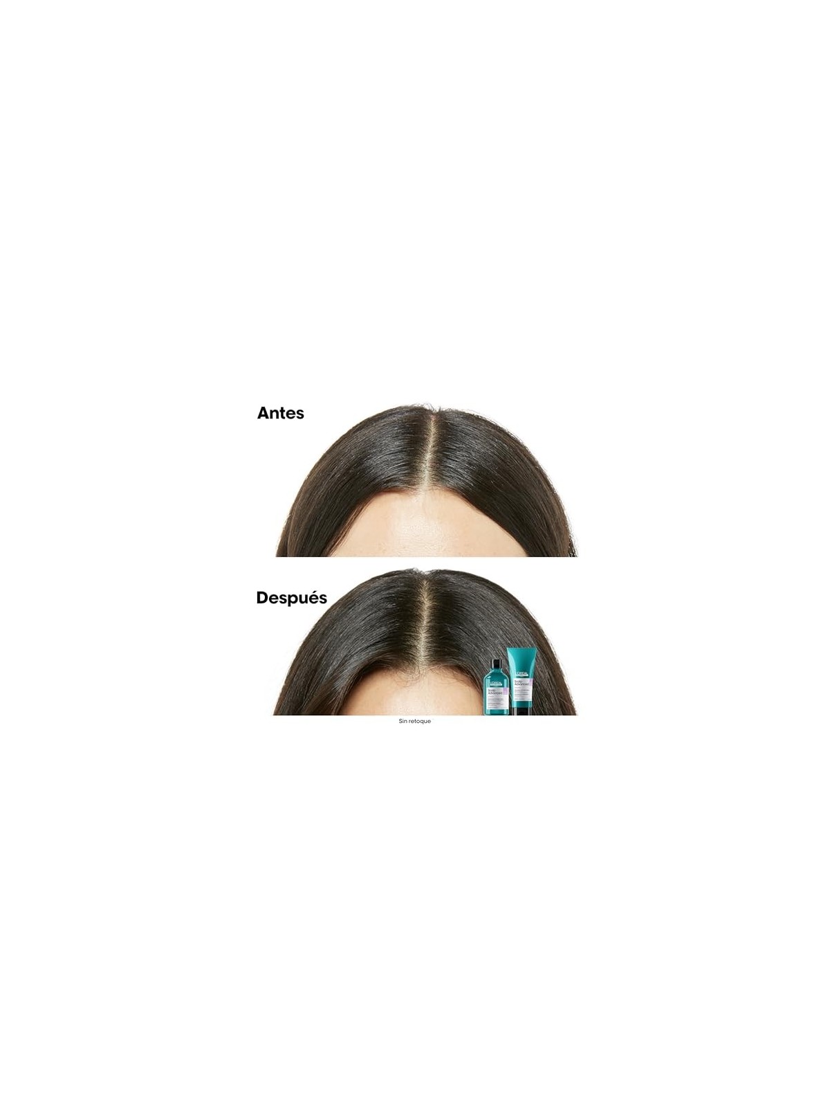 L'Orï¿½ï¿½al Professionnel Paris Scalp Advanced Shampoo 300ml