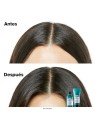 L'Orï¿½ï¿½al Professionnel Paris Scalp Advanced Shampoo 300ml