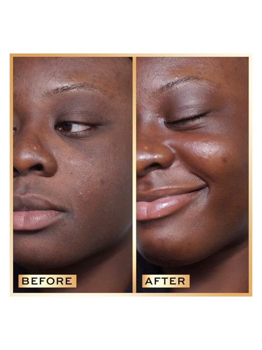 Siero Revolution PRO Miracle per la pelle 30ml