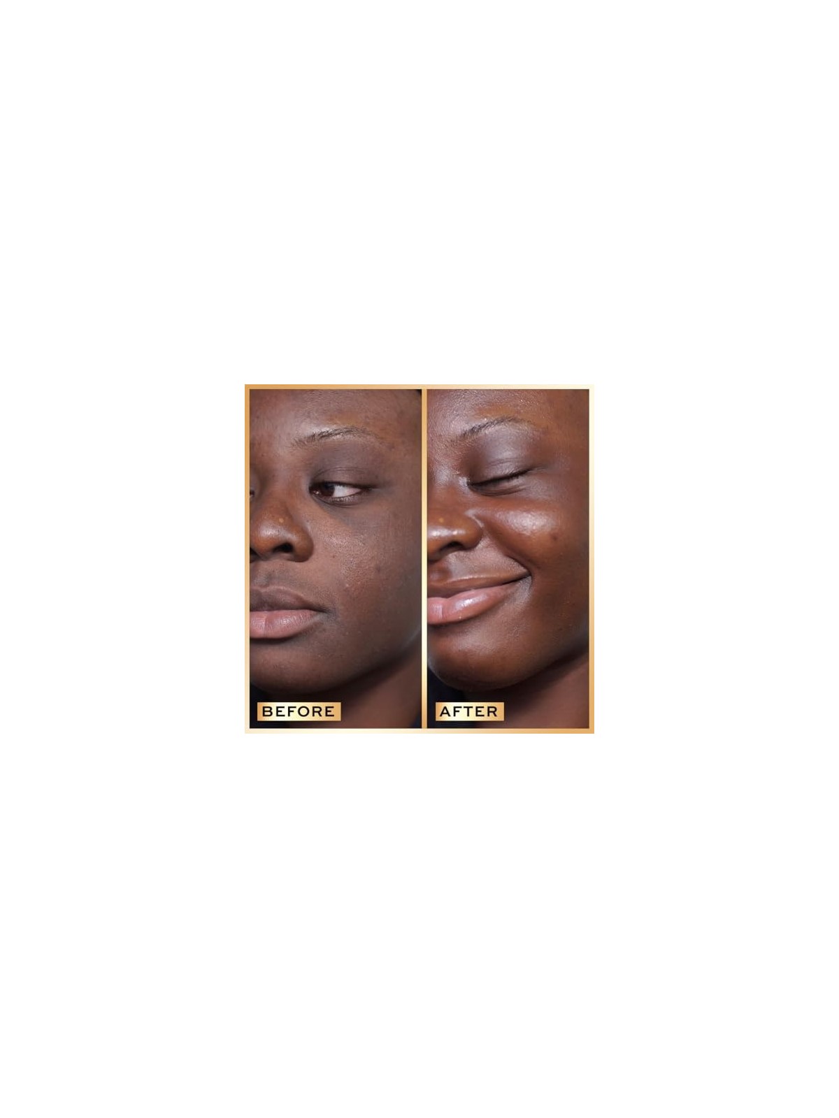 Siero Revolution PRO Miracle per la pelle 30ml
