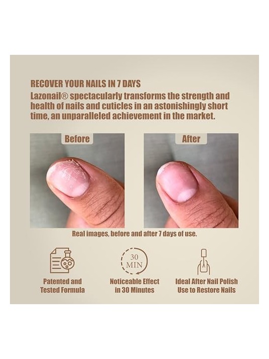 Lazonail LAZONAIL Nail Hardener 25ml
