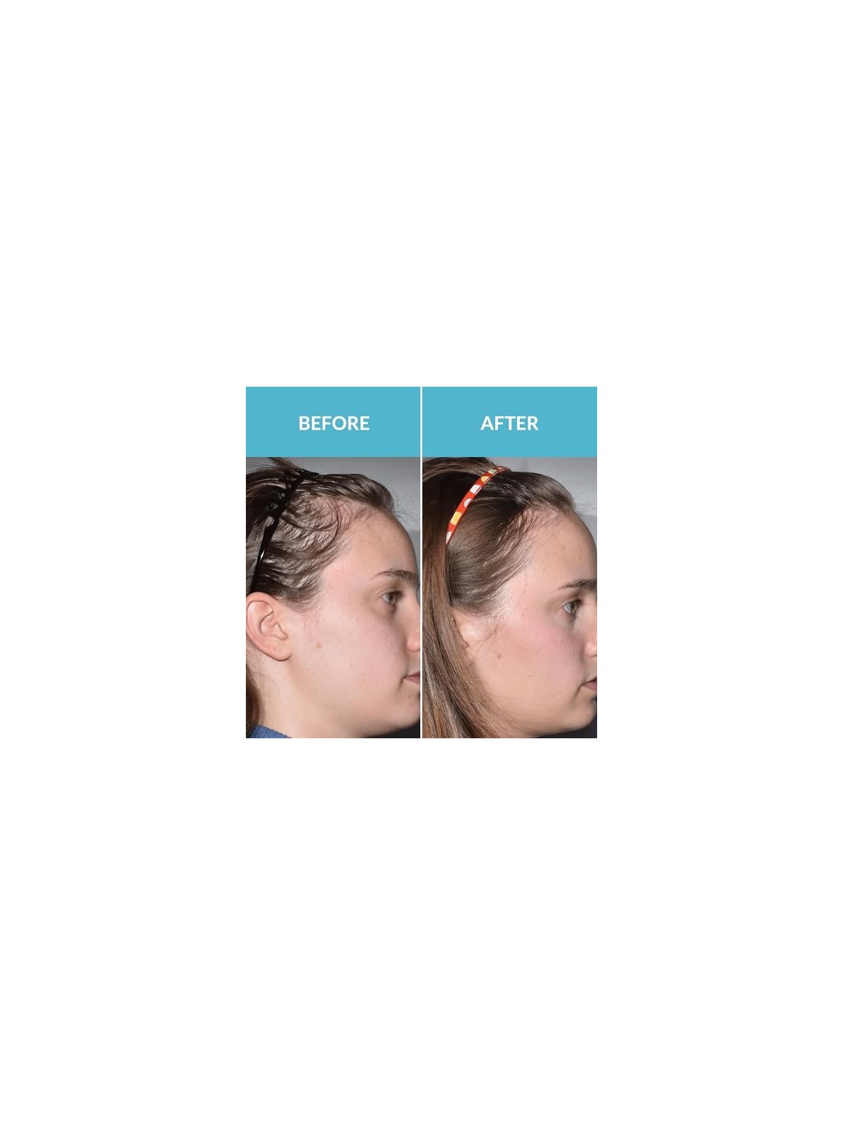 Talika SERUM FORZA CAPELLI 50ml donna
