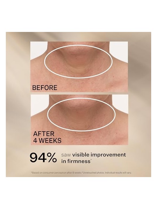 Strivectin TL Advanced Tightening Neck Cream 30ml StriVectin www.essenzetotalstyle.com 