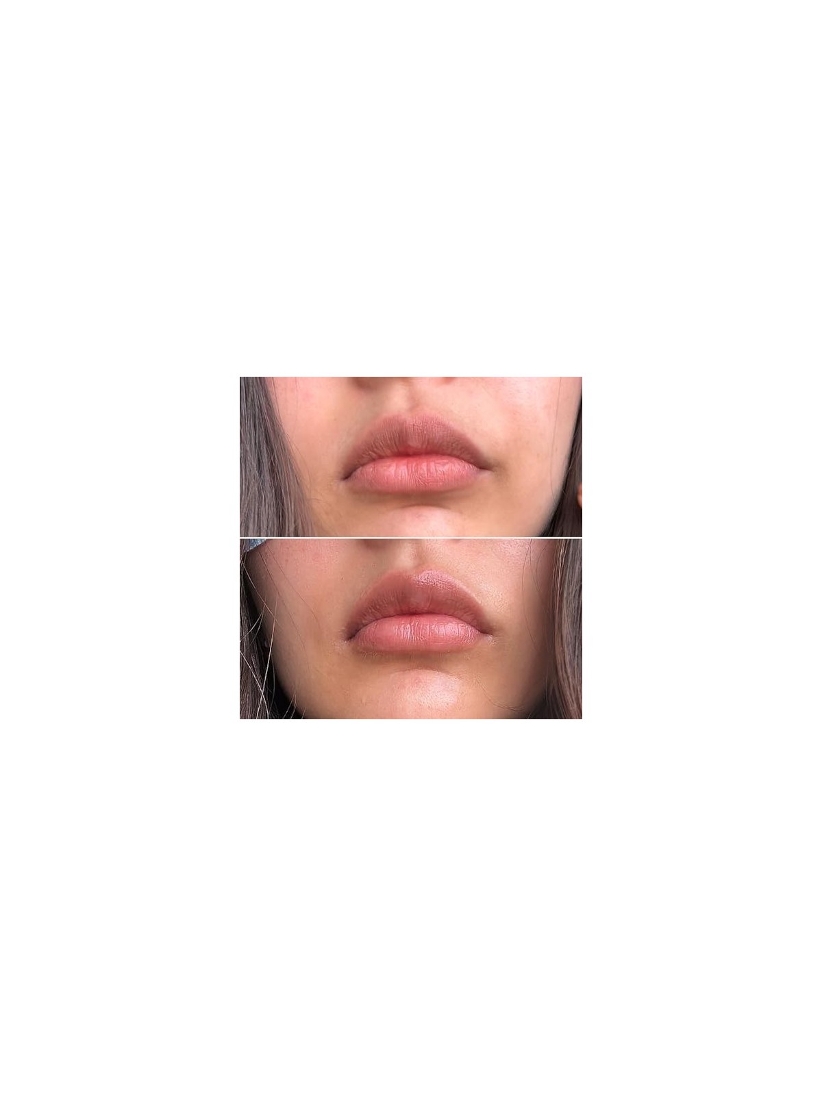 Talika SMILE PATCH patch idratante per labbra 1 unit donna