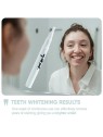 My White Secret Whitening Pen with PAP for Women
