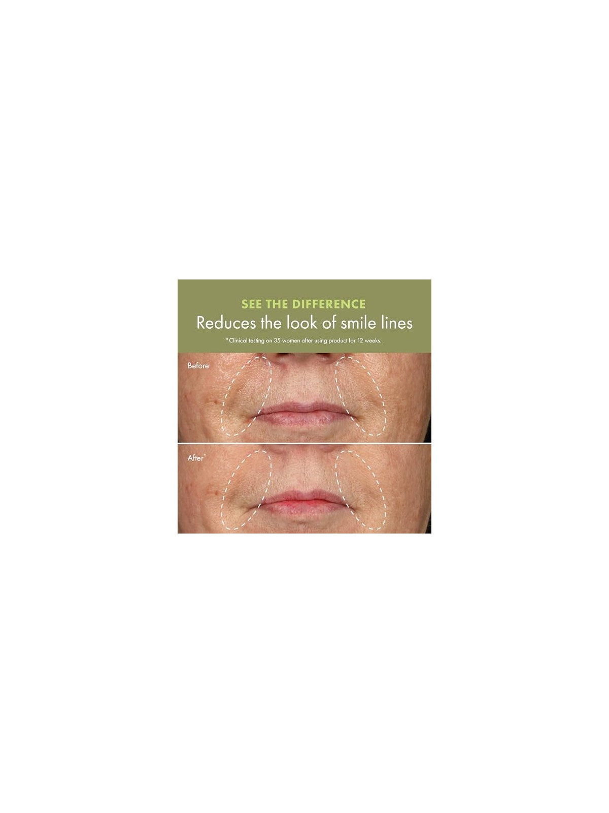 Origins Plantscription Active Wrinkle Correction Serum 30ml