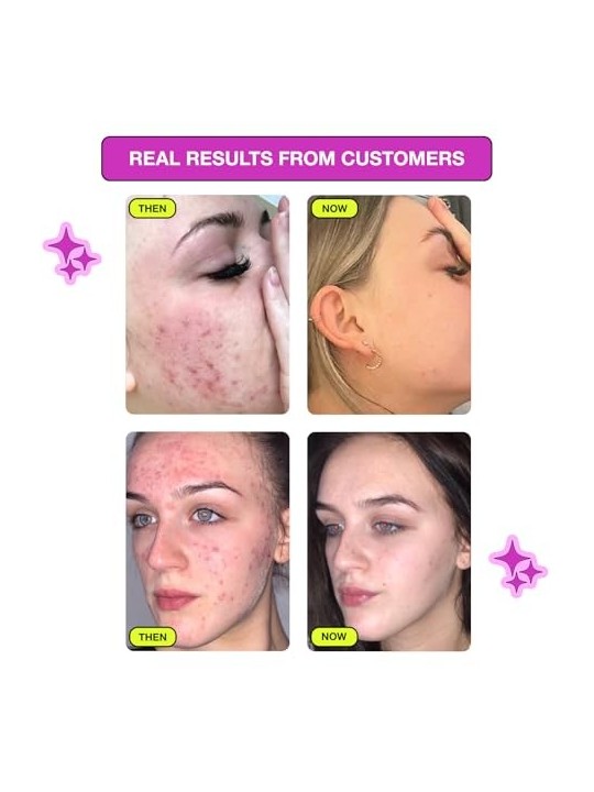 Sapone detergente viso Carbon Theory Niacinamide