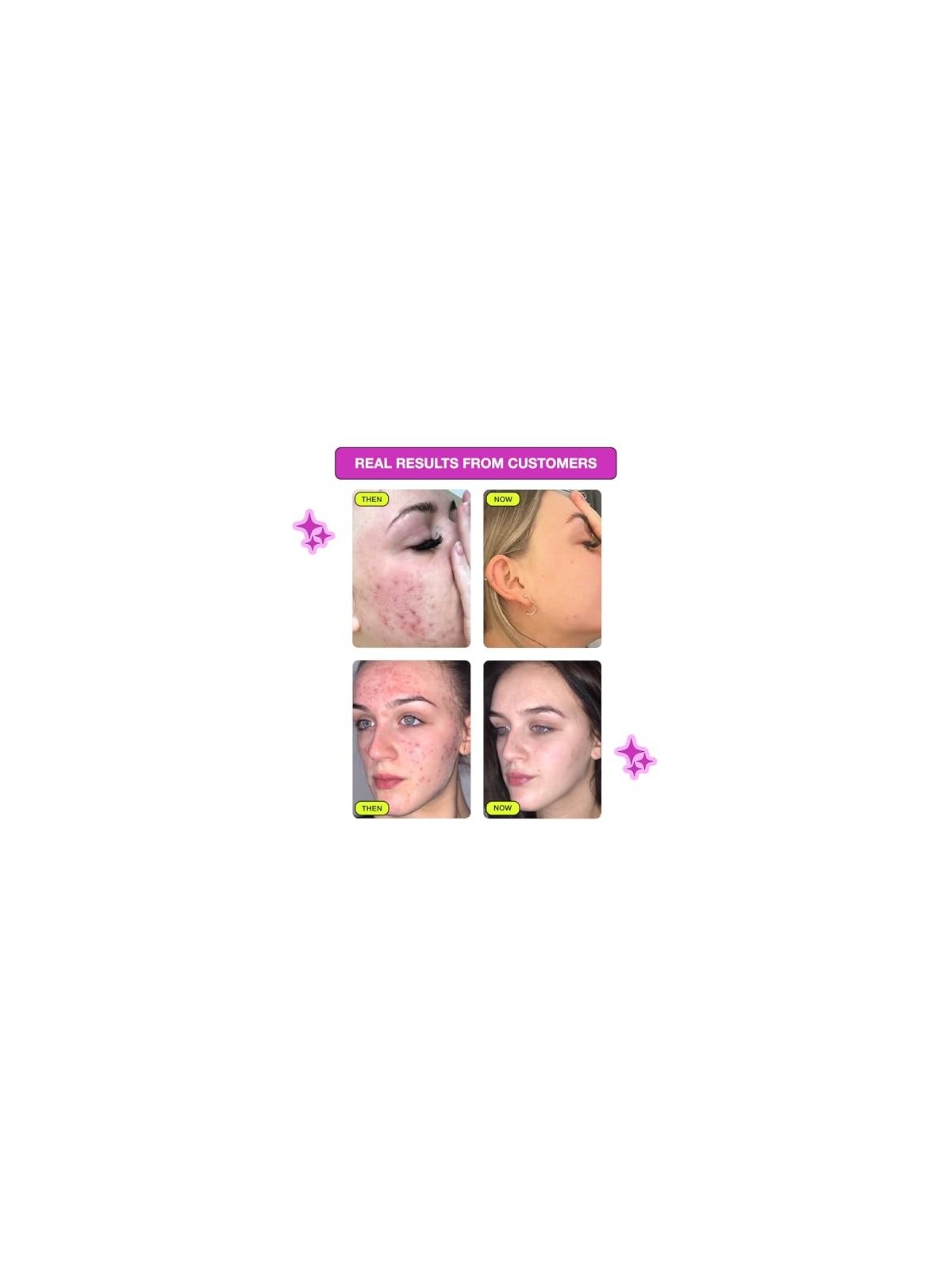 Sapone detergente viso Carbon Theory Niacinamide