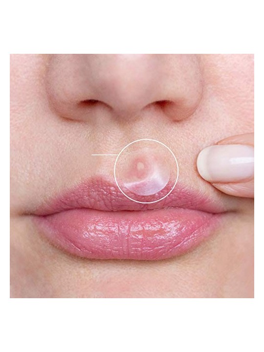 Breakoutaid Emergency Dots Cerotti per pelli sensibili soggette ad acne donna