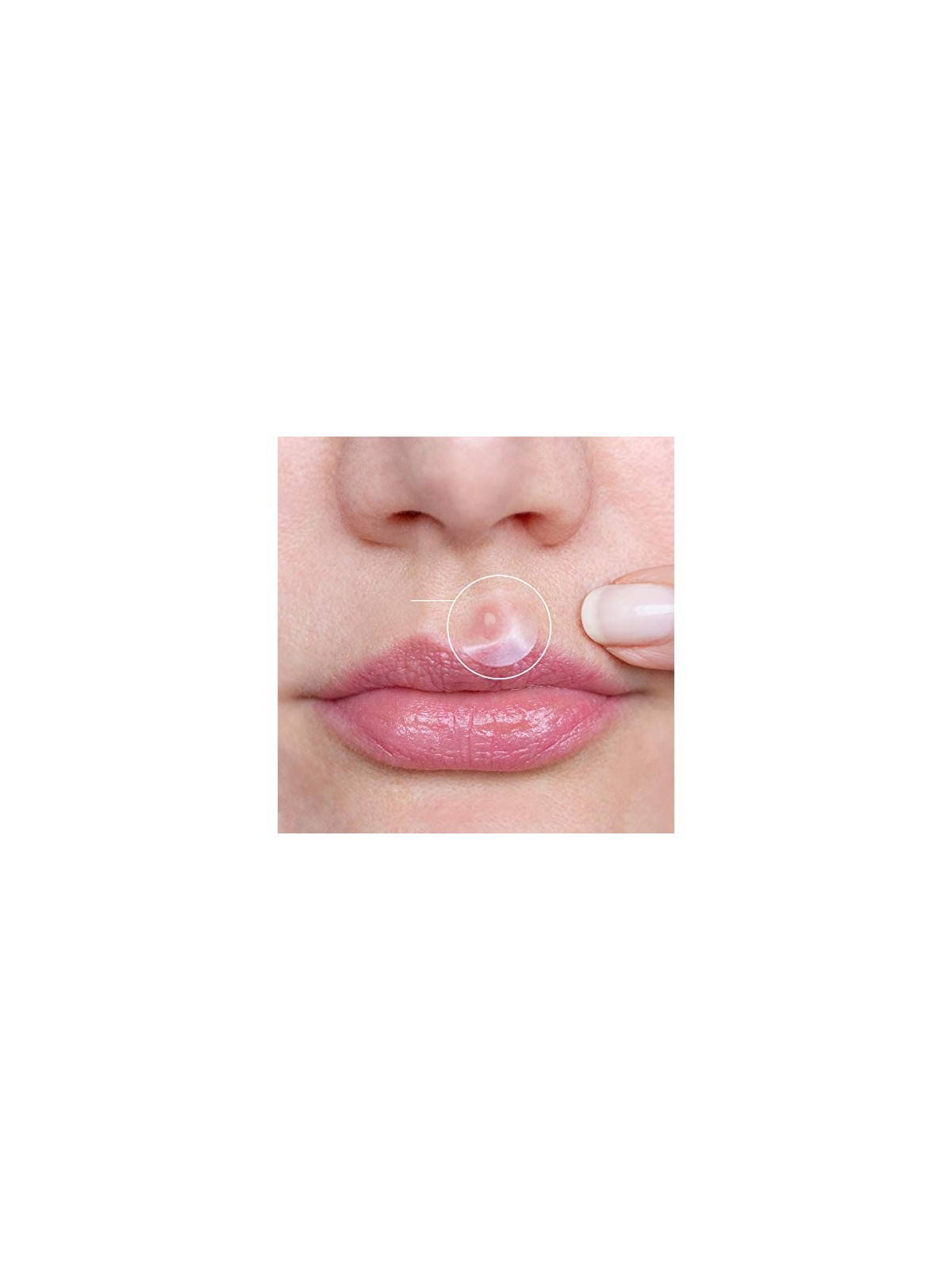 Breakoutaid Emergency Dots Cerotti per pelli sensibili soggette ad acne donna