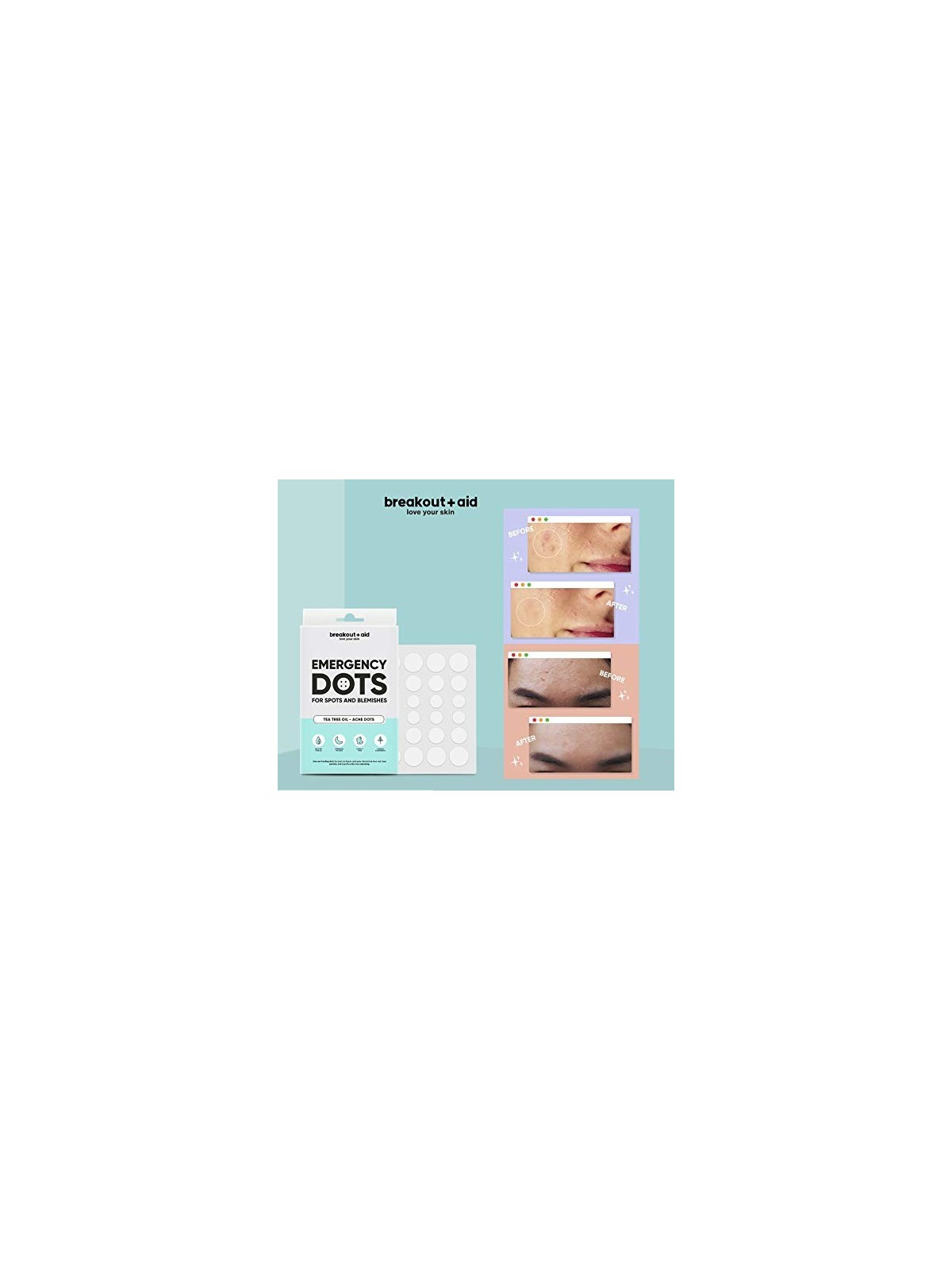 Breakoutaid Emergency Dots Cerotti per pelli sensibili soggette ad acne donna