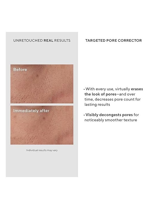 Murad Targeted Pore Corrector 15ml acquista