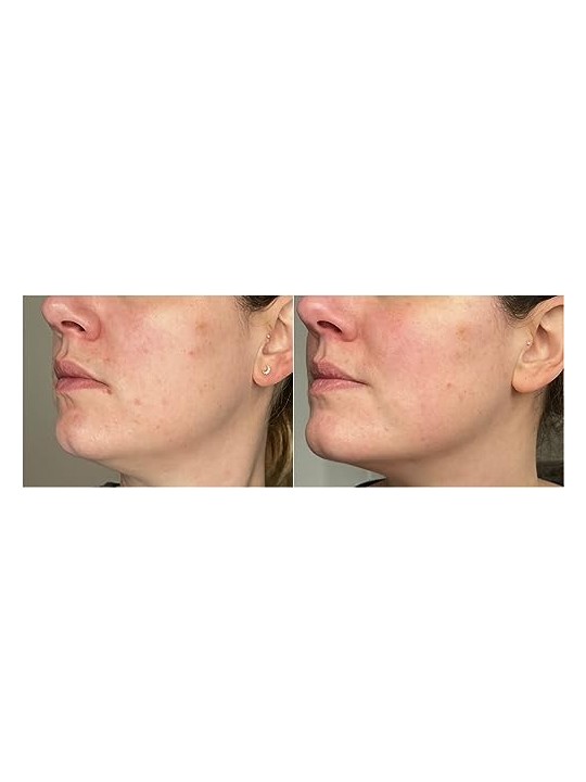 Erborian Juza Cure Cura intensiva e rinforzante della pelle donna 25ml