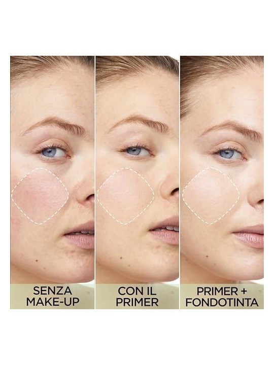 LOrï¿½ï¿½al Gomma per arrossamenti 24 ore Prime Lab donna 30ml