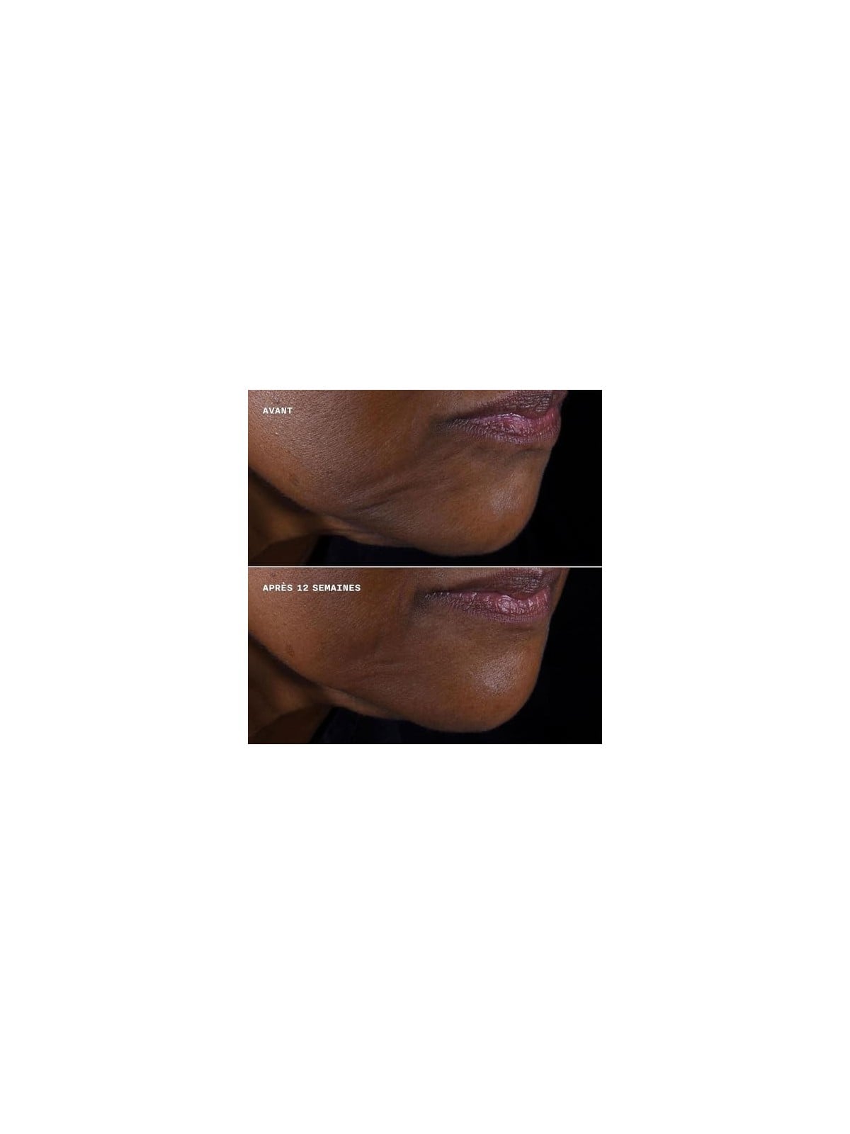 Clinique Smart Clinical Repair Lifting Face  Neck Cream 50ml