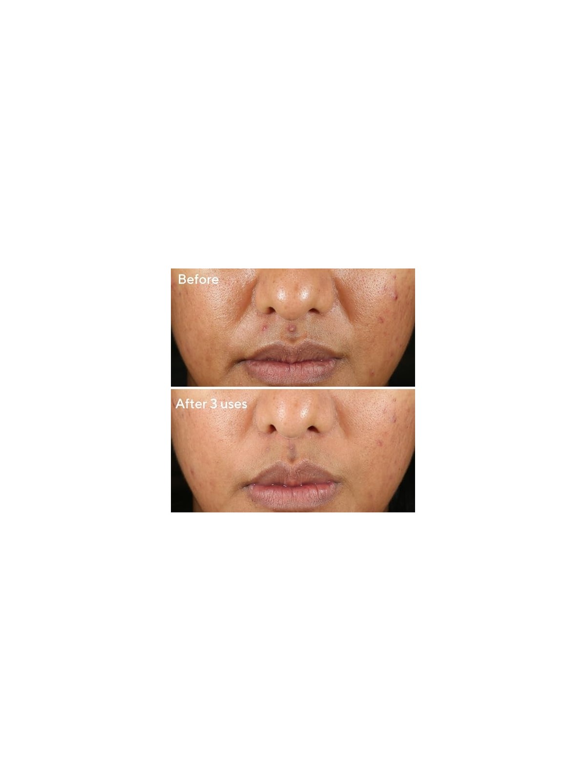 Murad Rapid Relief Sulfur Mask 74ml Murad Skincare www.essenzetotalstyle.com 
