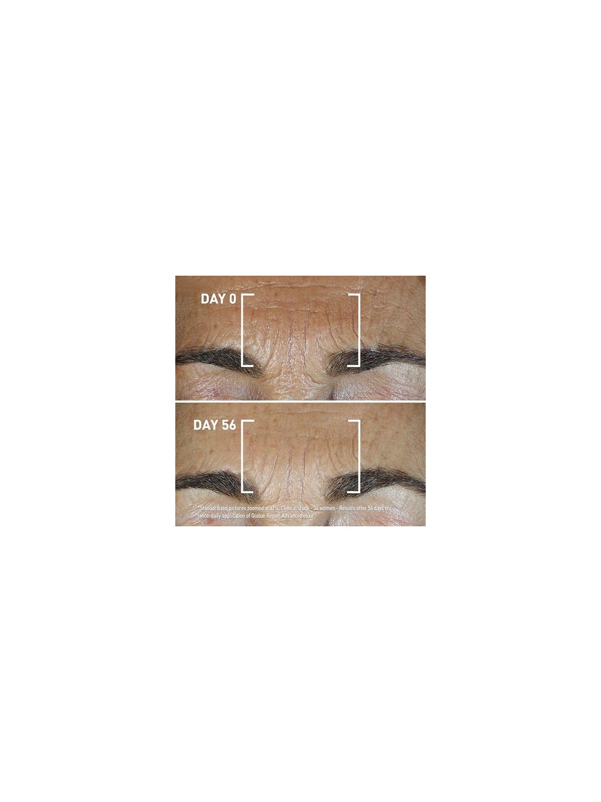 Siero viso antietï¿½ï¿½ Filorga Global Repair 30ml