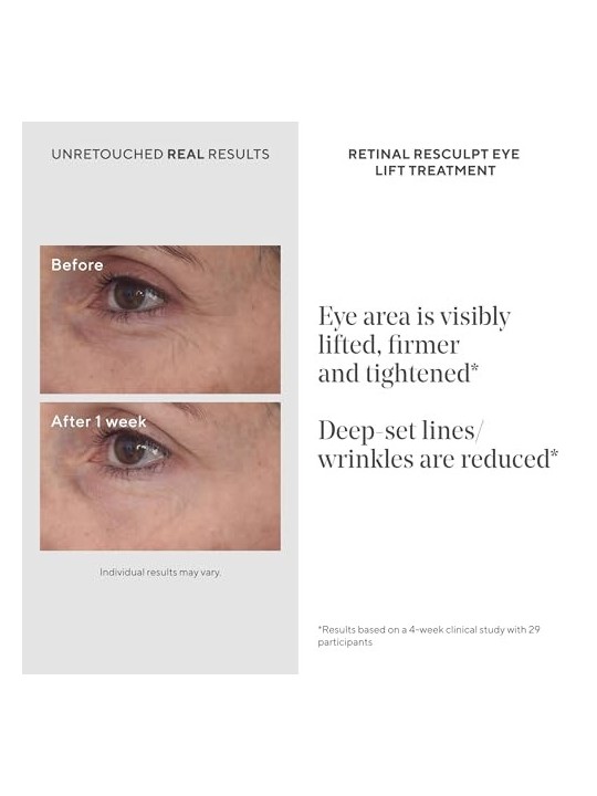 Murad Retinal ReSculpt Eye Treatment 15ml Murad Skincare www.essenzetotalstyle.com 