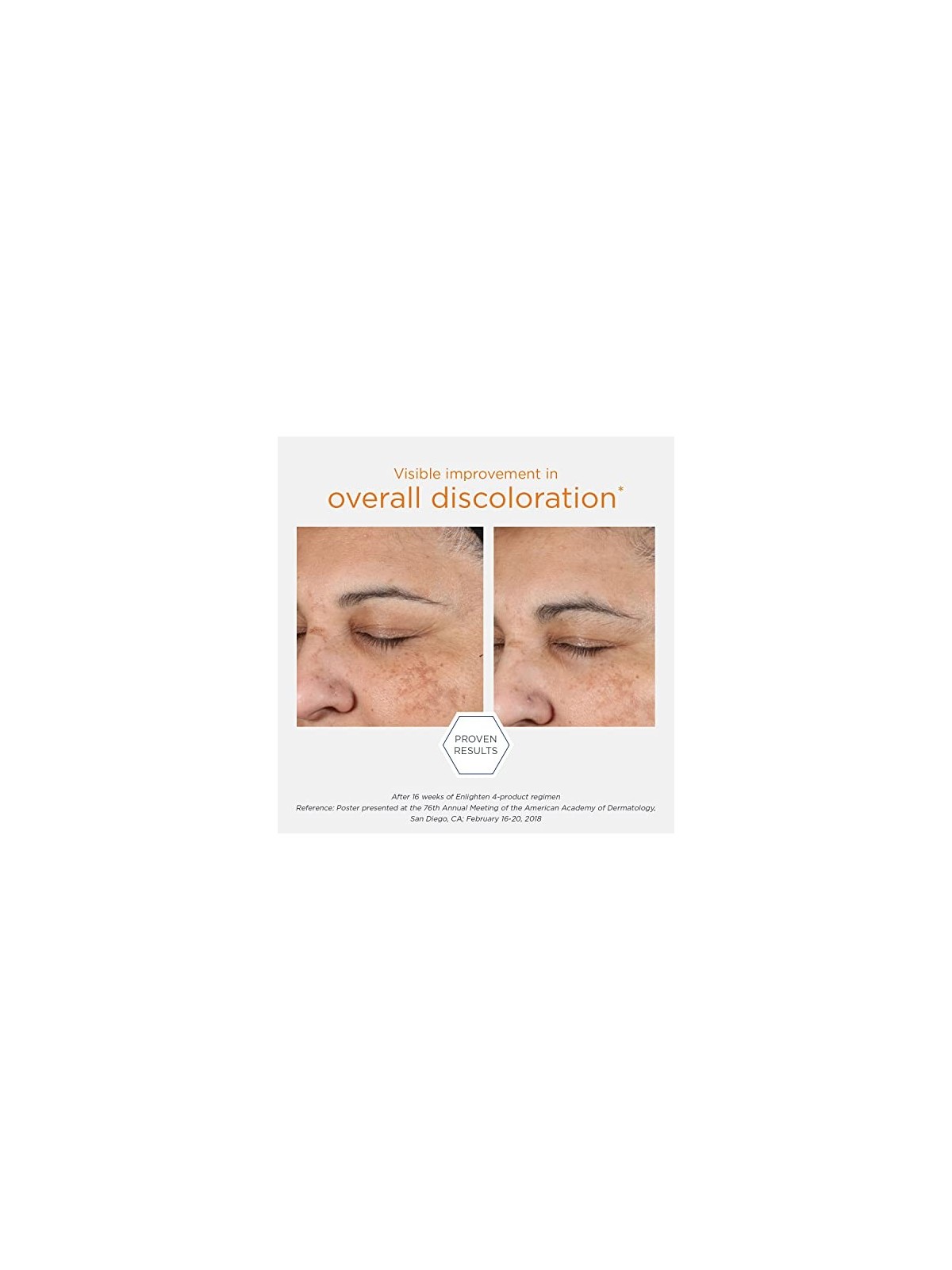 NeoStrata Fluido schiarente quotidiano Enlighten Pigment Controller 50ml donna NeoStrata www.essenzetotalstyle.com 