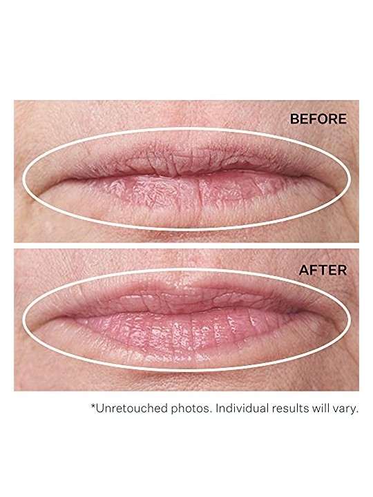 Strivectin Double Fixï¿½ï¿½ï¿½ per Labbra 10ml