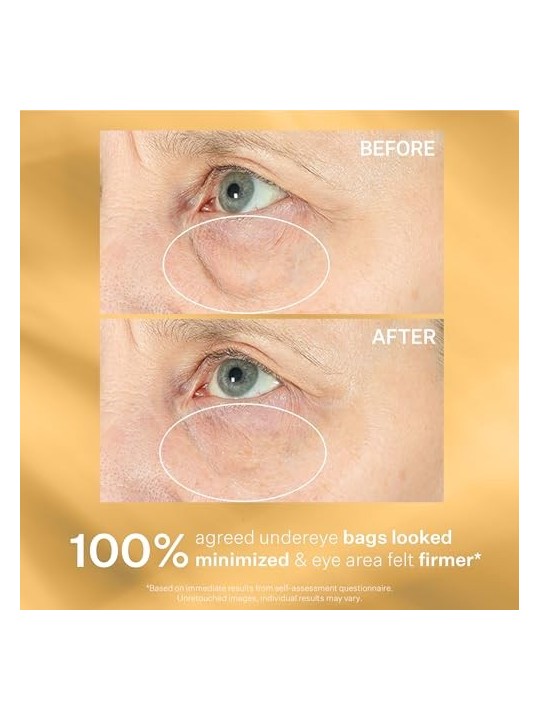 StriVectin Siero contorno occhi per borse e gonfiori TL Hyperlift Eye™ Instant Eye Fix 10ml donna StriVectin www.essenzetotalsty