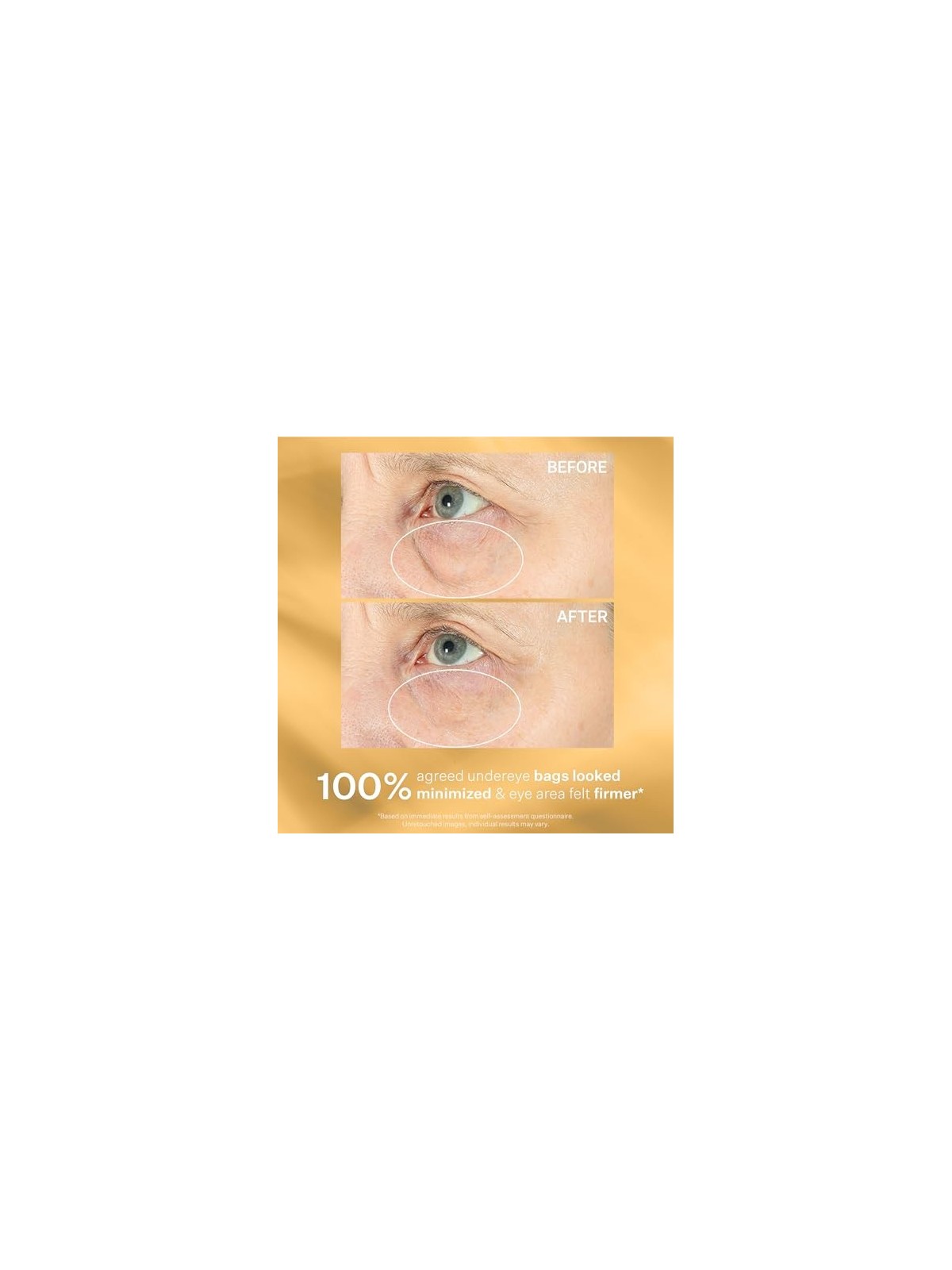 StriVectin Siero contorno occhi per borse e gonfiori TL Hyperlift Eye™ Instant Eye Fix 10ml donna StriVectin www.essenzetotalsty