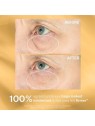 StriVectin Siero contorno occhi per borse e gonfiori TL Hyperlift Eye™ Instant Eye Fix 10ml donna StriVectin www.essenzetotalsty