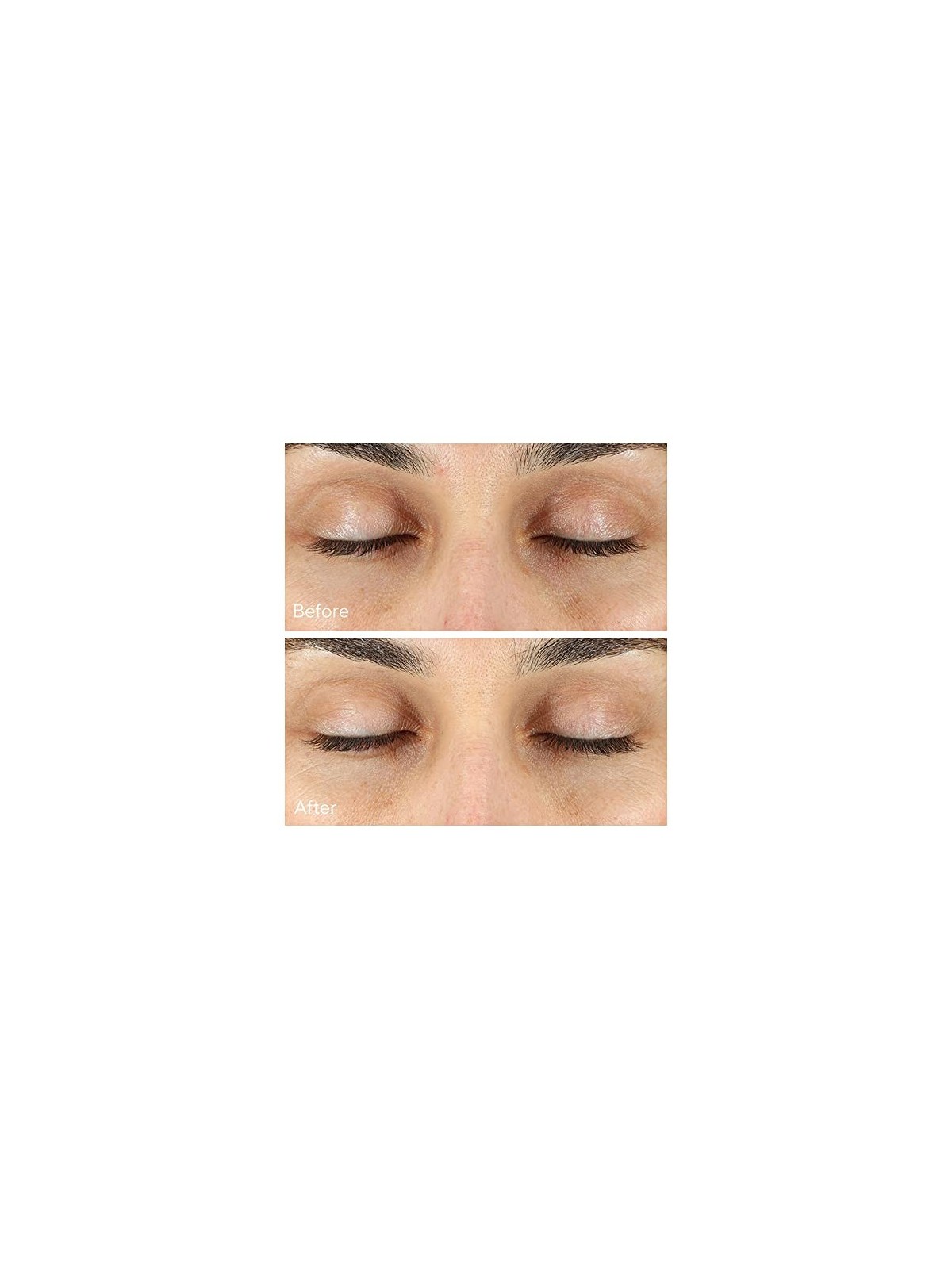 Murad Vita-C Rapid Dark Circle Corrector 15ml Murad www.essenzetotalstyle.com 