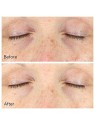 Murad Vita-C Rapid Dark Circle Corrector 15ml Murad www.essenzetotalstyle.com 