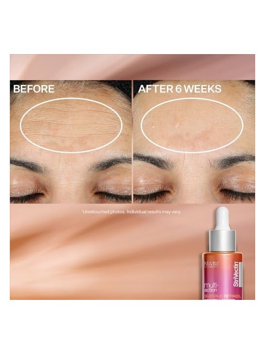 Siero Viso Strivectin Super-C Retinol Brighten & Correct 30ml
